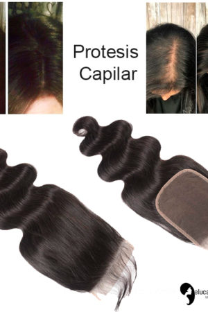 Protesis Capilar Alopecia