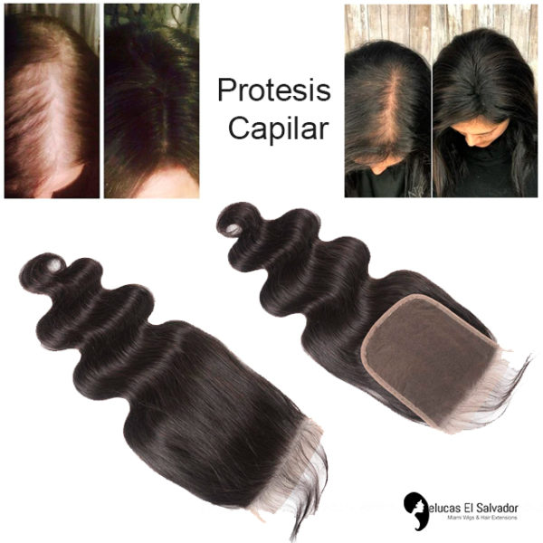 Protesis Capilar Alopecia